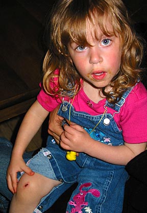 emmas-boo-boos01